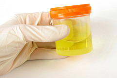 Гликозурия почечная