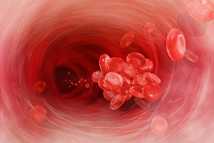 Инсулинома