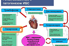 Ишемическая болезнь сердца (ИБС) Ишемическая болезнь сердца