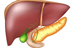 Холецистит